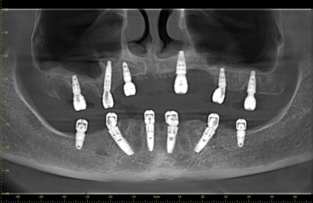 3D KT Diagnostika